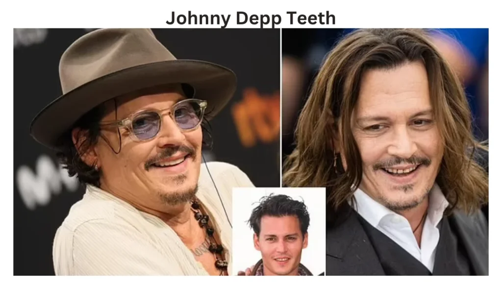 johnny depp teeth